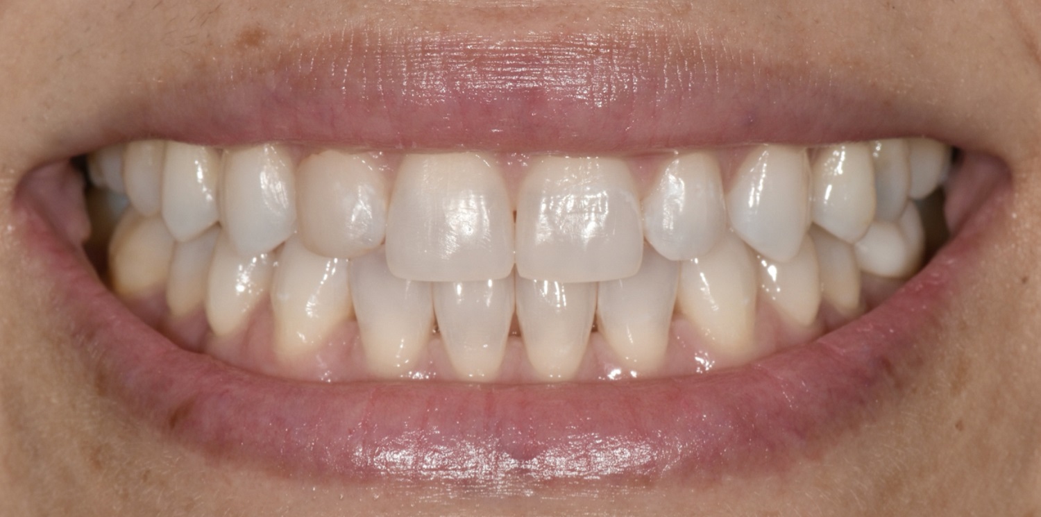 Before Image