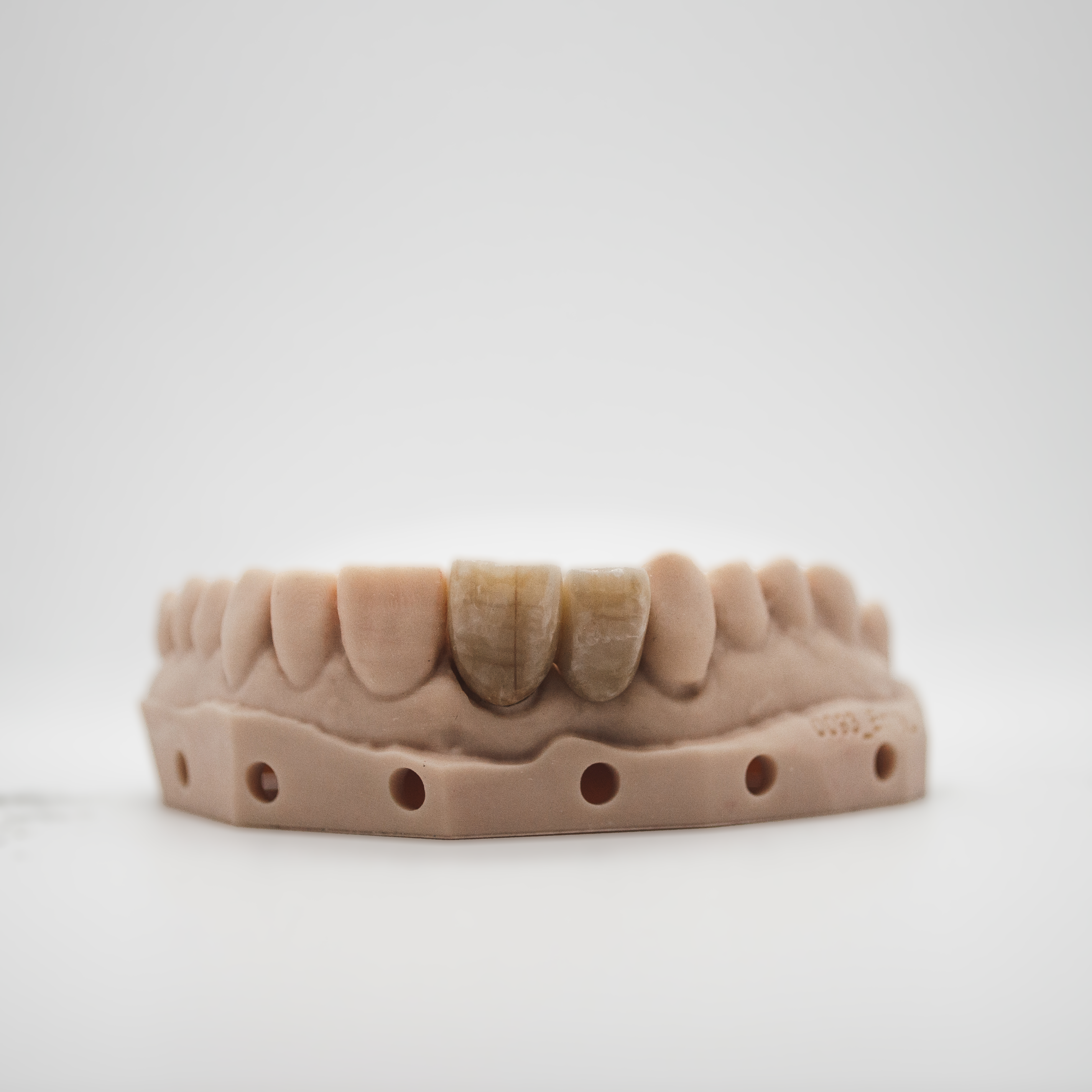 Zirconia Bridge Image