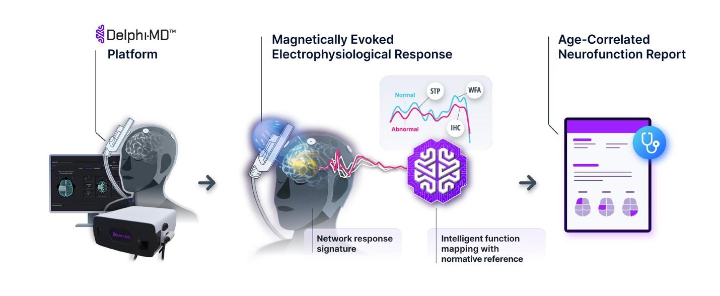 Delphi-MD workflow: the platform captures a magnetically evoked electrophysiological response and produces an age-correlated neurofunction report