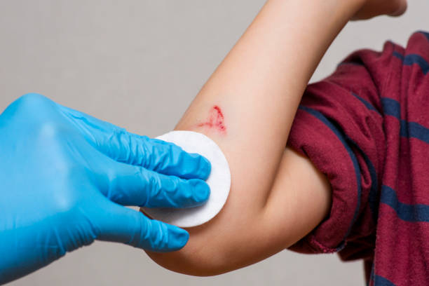 Boy getting wound cleaned by dermatologist.