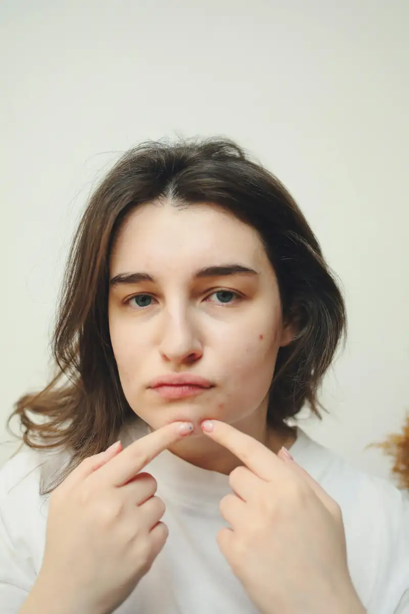 Woman popping pimple at home.