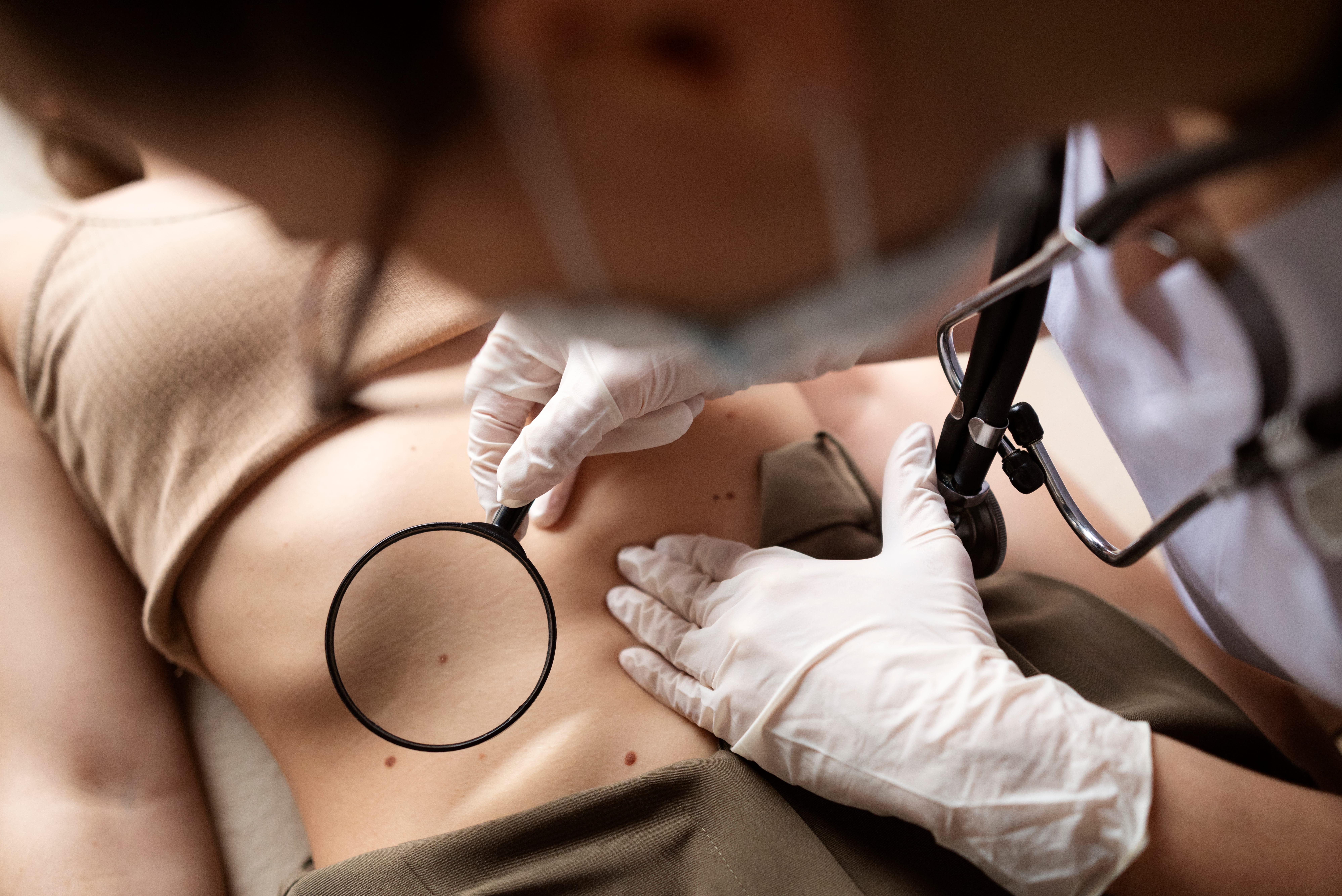Dermatologist examining a skin lesion with magnification during a skin exam.