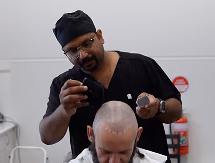 Hair transplant specialist marking the new hairline before a hair restoration procedure.