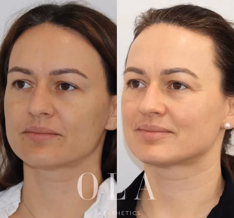 Side-by-Side Before and After
