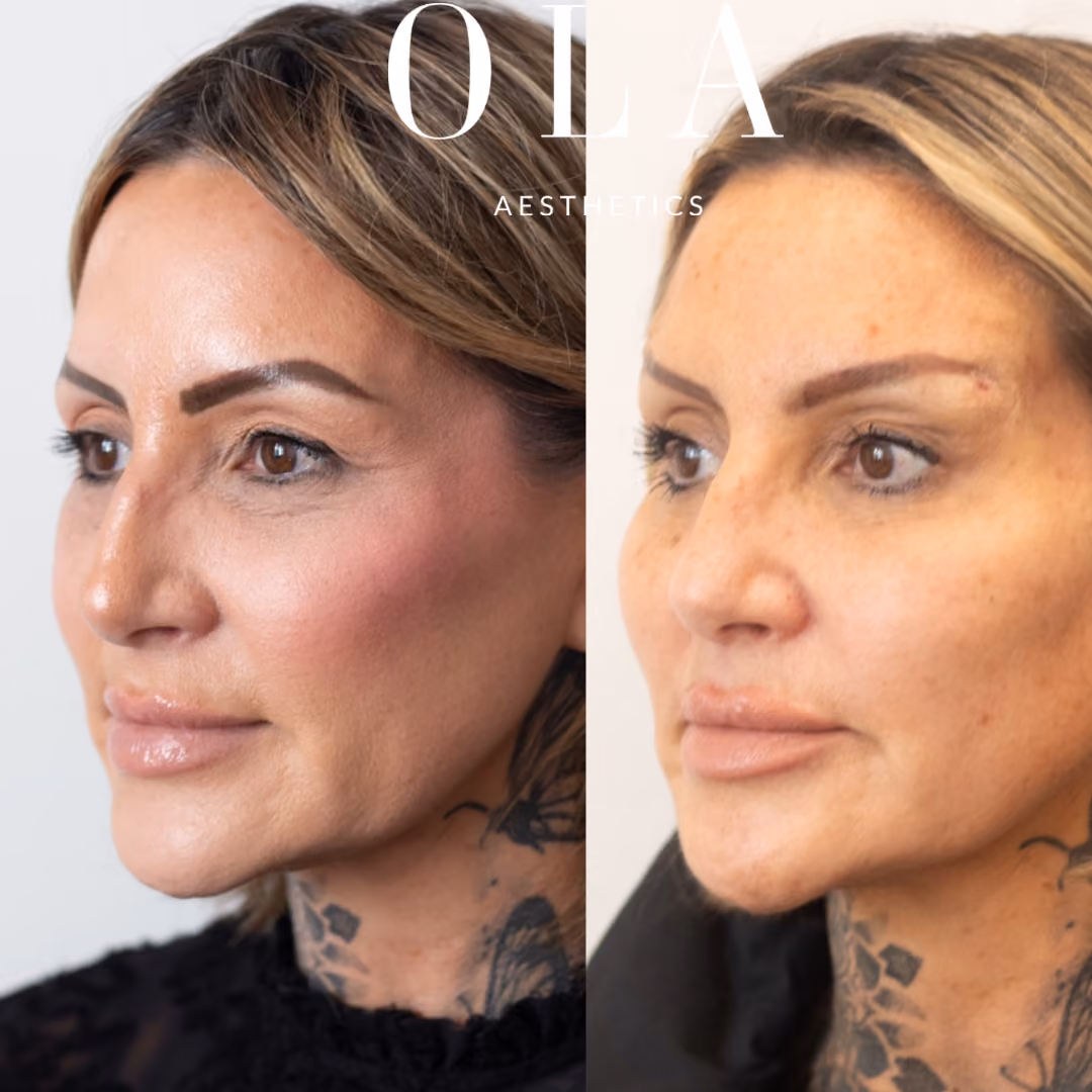 Side-by-Side Before and After