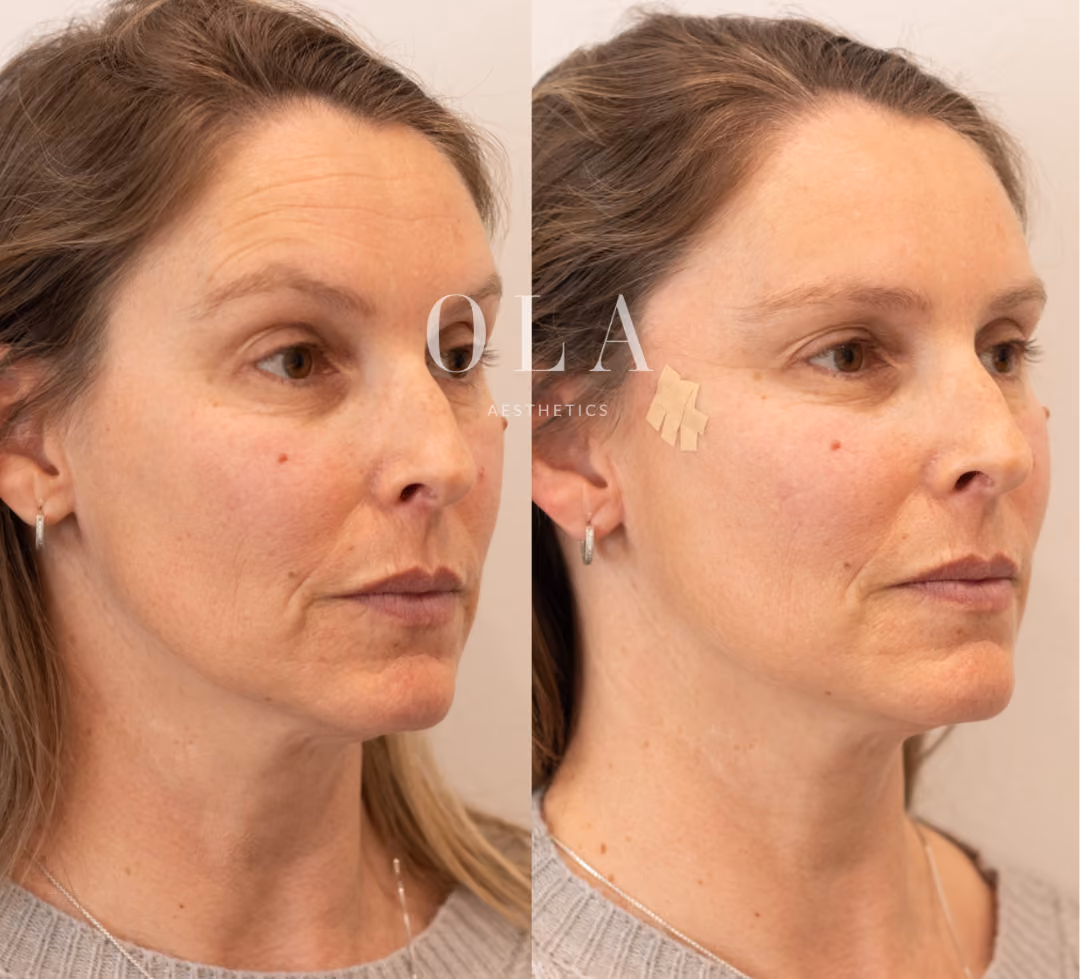 Side-by-Side Before and After