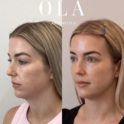 Side-by-Side Before and After