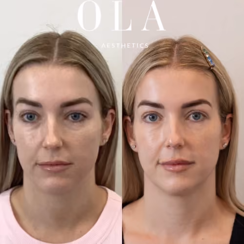 Side-by-Side Before and After