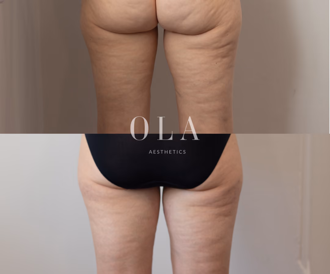 Stacked Before and After