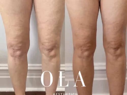 Side-by-Side Before and After