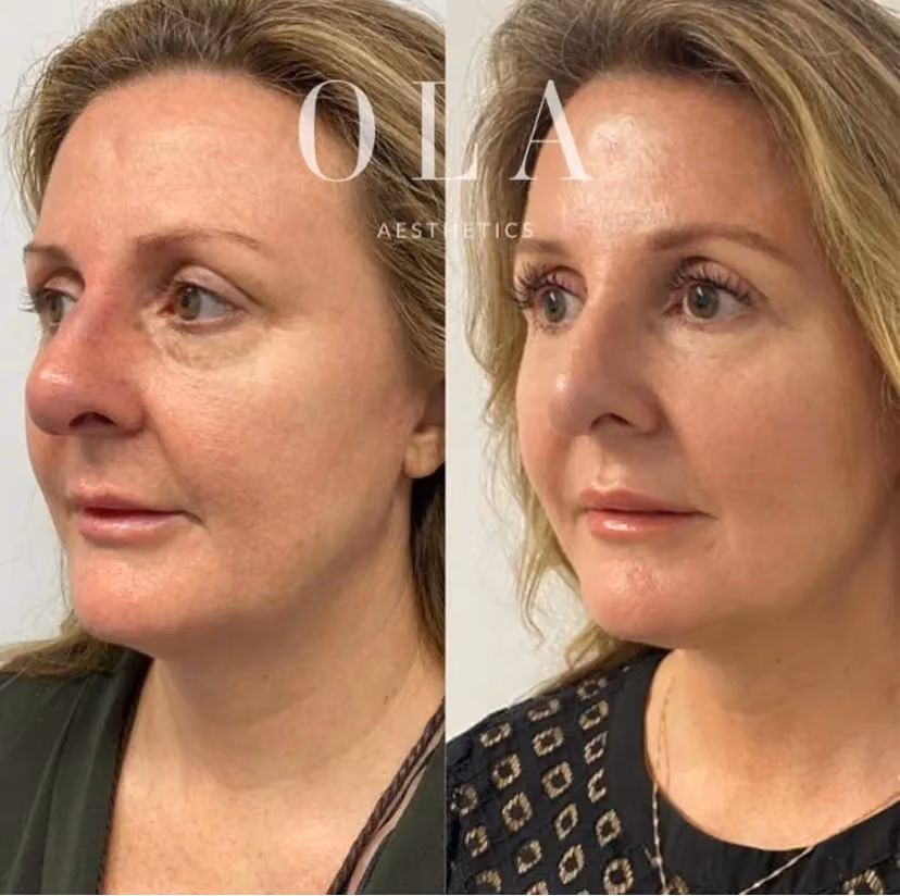 Side-by-Side Before and After