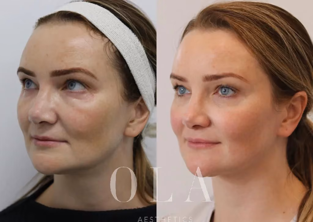 Side-by-Side Before and After