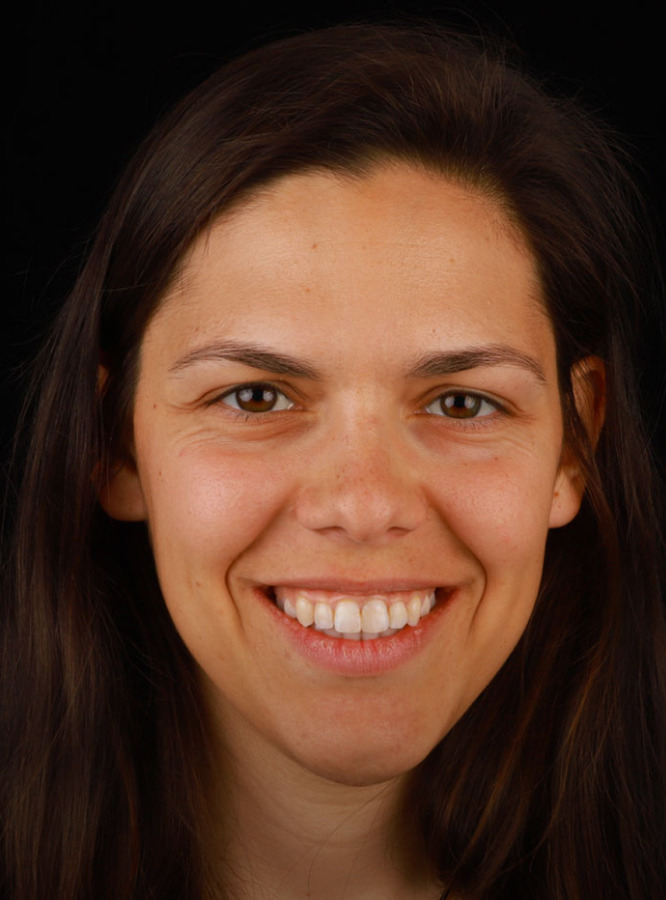 Leandra, paciente de ortodontia da Clínica Parque da Cidade