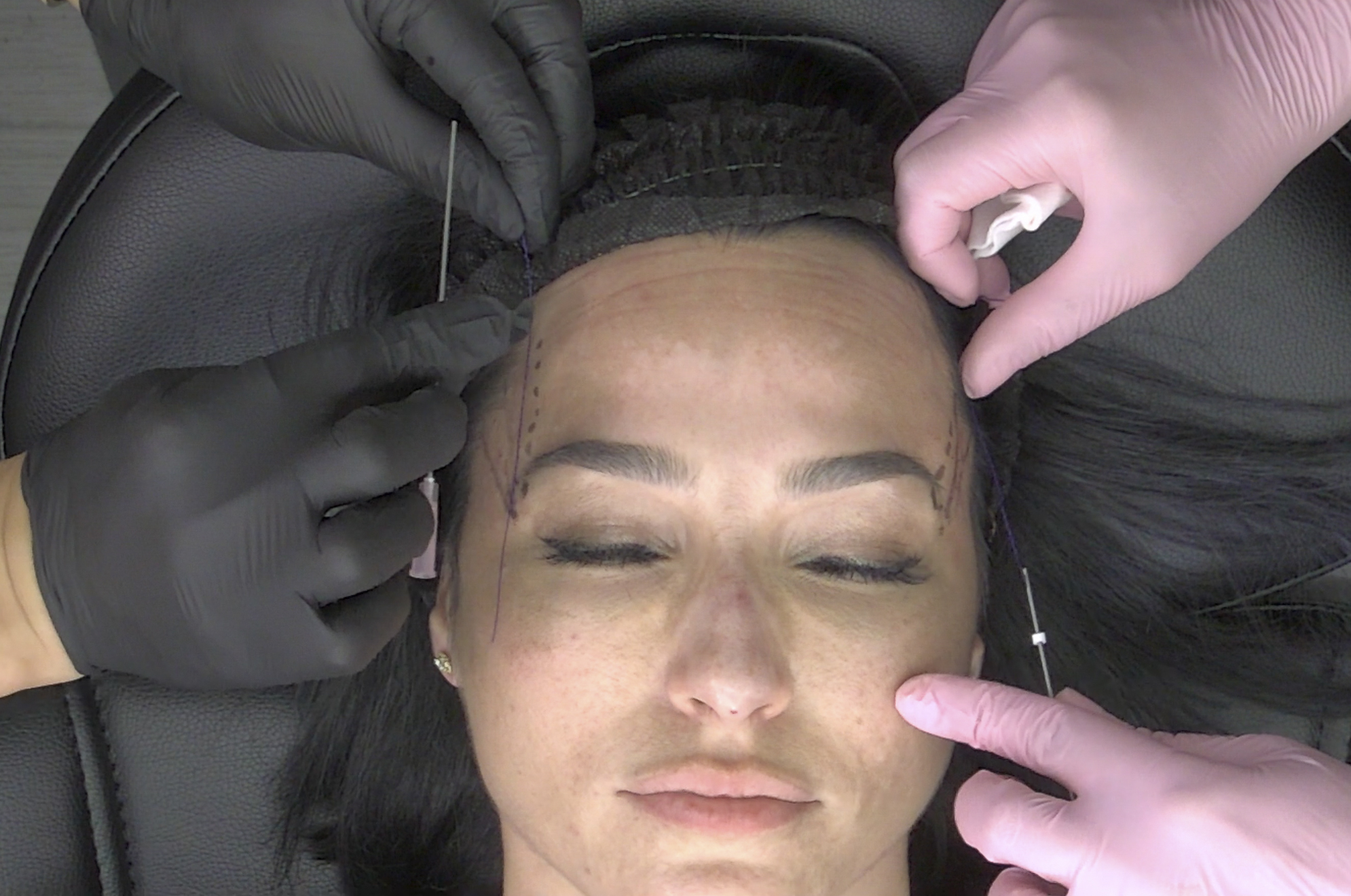 INJECTION TRAINING - 
Cutting Edge Techniques