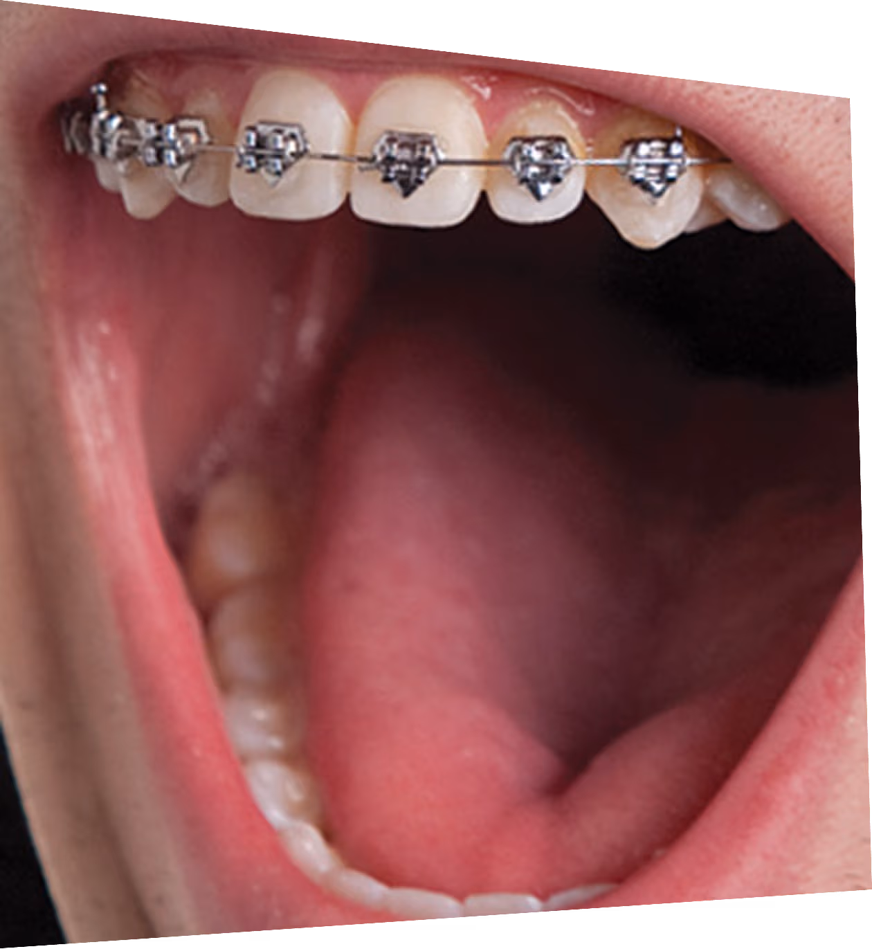 Before and after of patients teeth