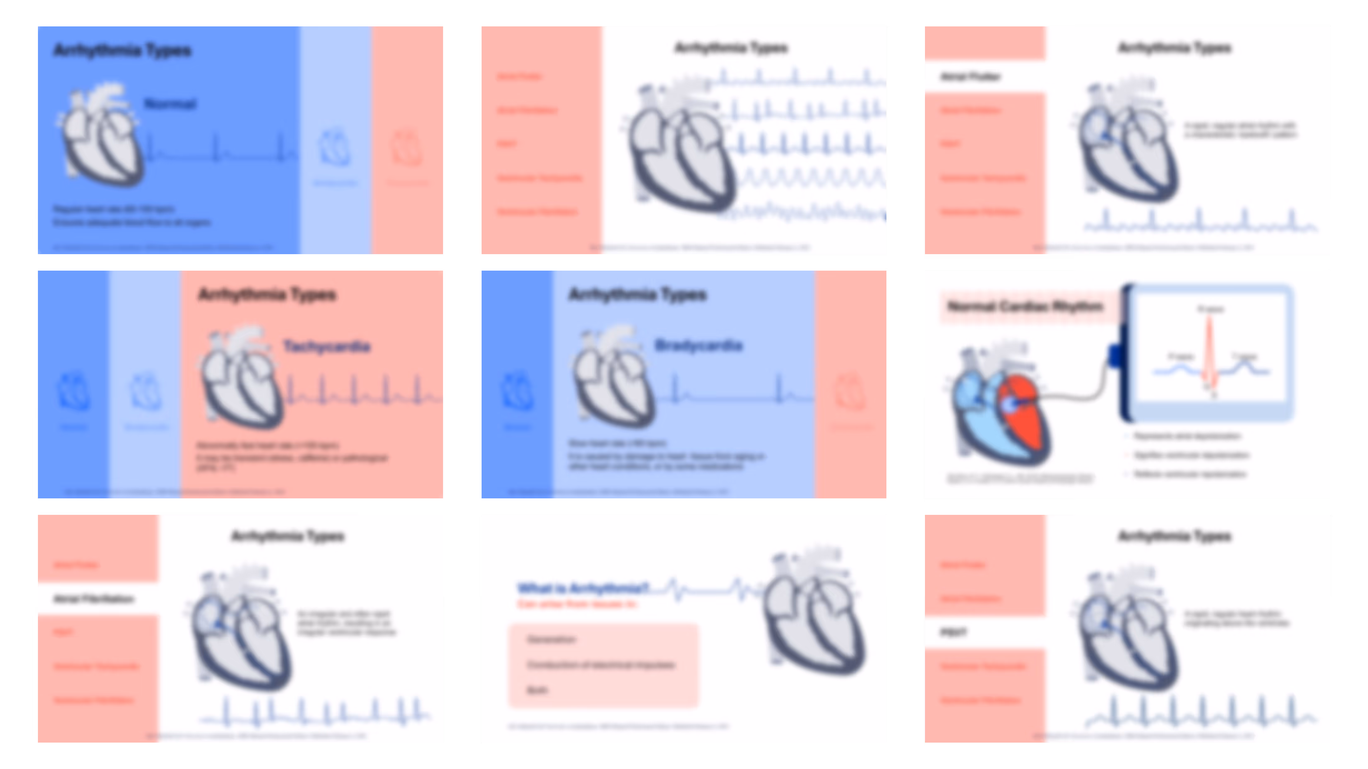 Arrhythmias slide deck example with infographics, heart rhythm visuals, and healthcare presentation design