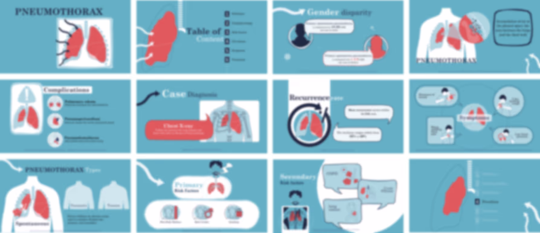 Pneumothorax overview presentation slides preview explaining causes, symptoms, diagnosis, and treatment options