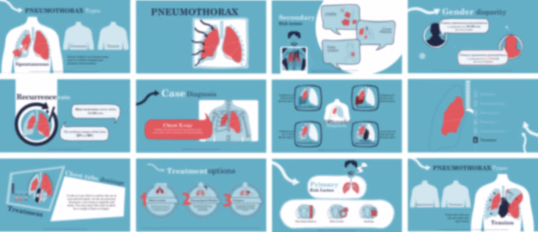 Ready-made pneumothorax overview presentation slides with medical content, charts, and clinical explanations