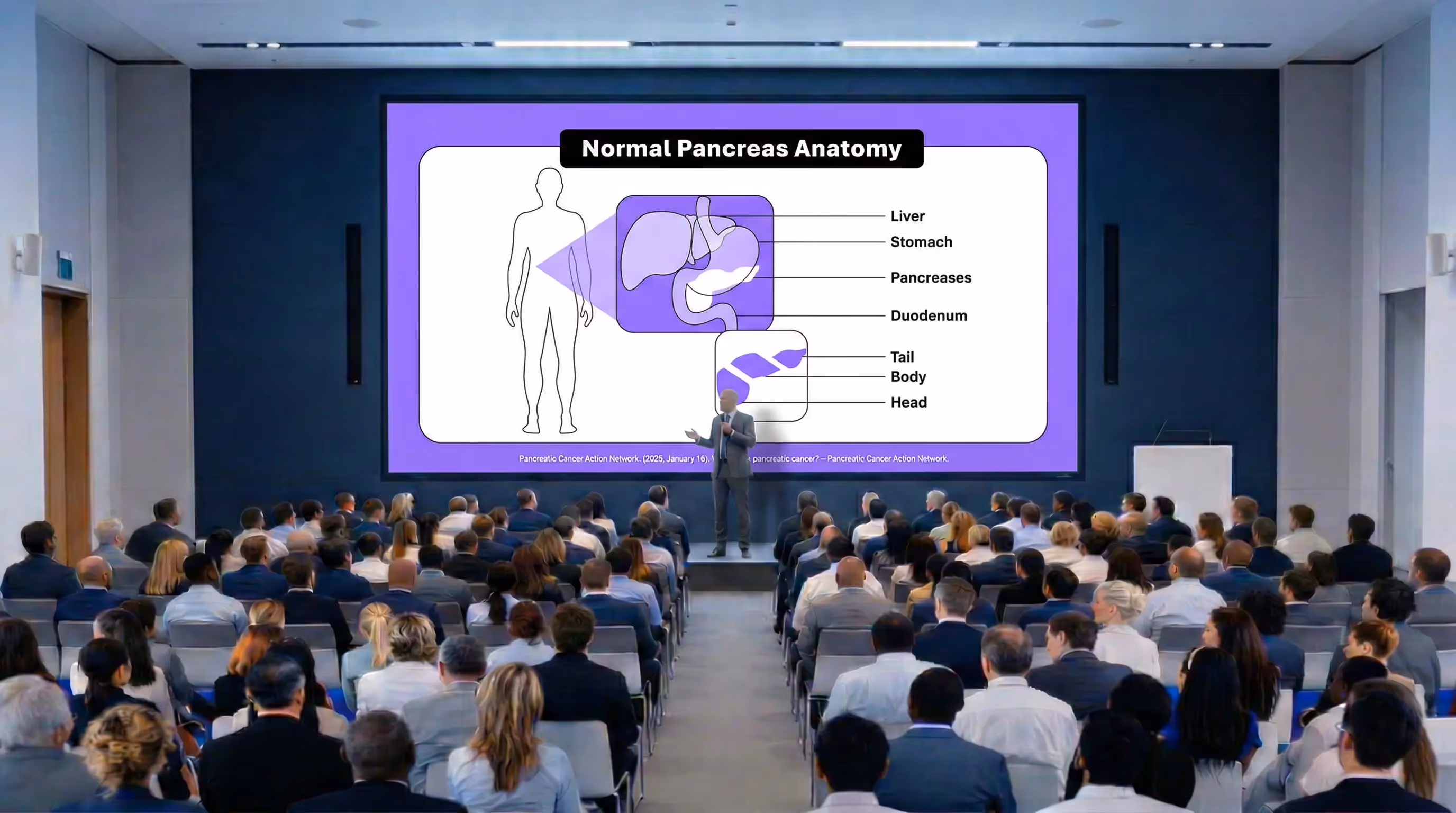 Pancreas anatomy presentation slide shown at a medical event in the USA