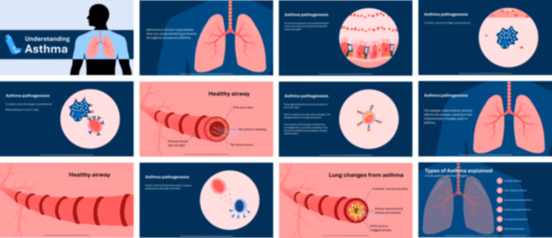 Asthma presentation slides preview showing airway inflammation, symptoms, triggers, and treatment strategies
