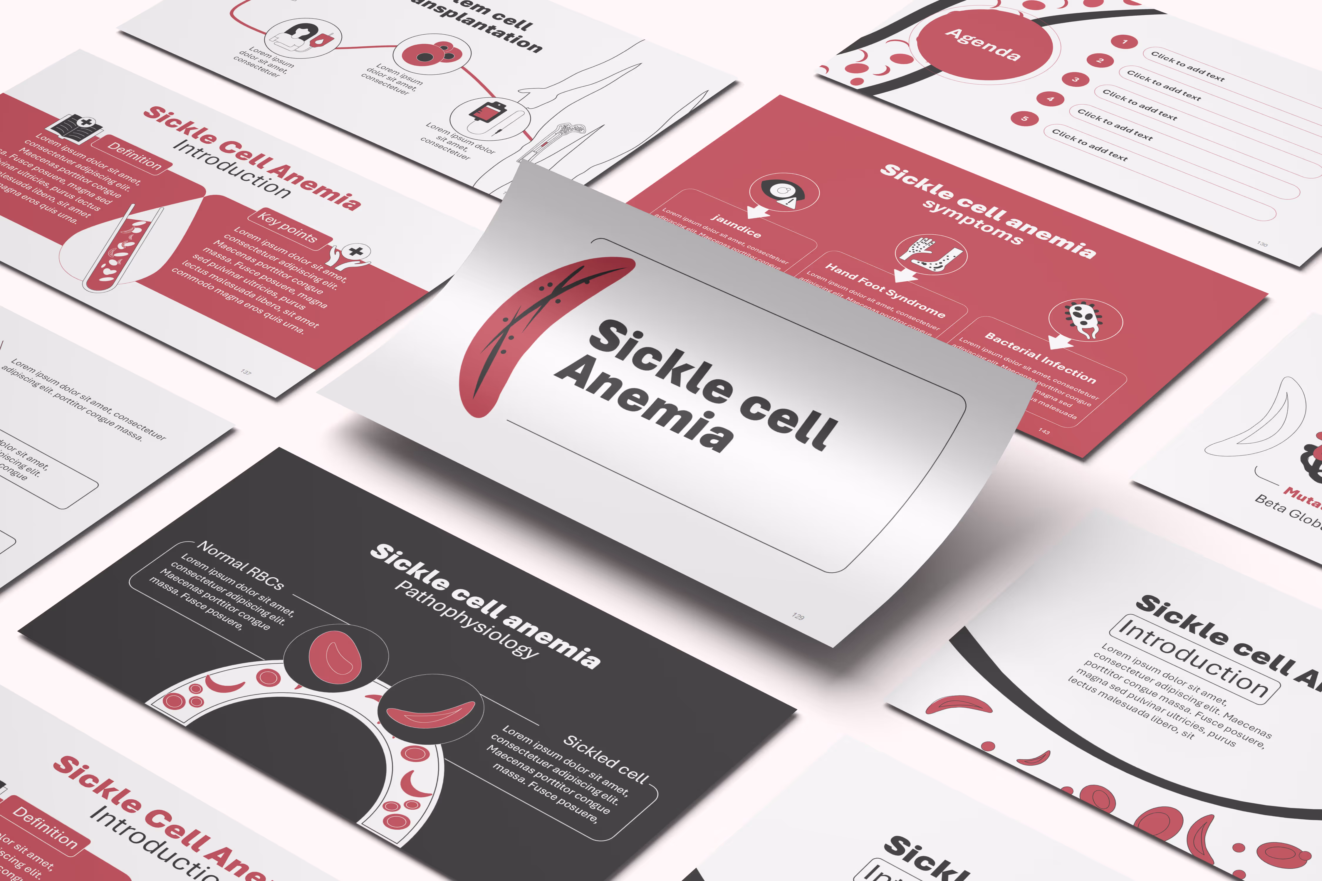 Editable animated sickle cell anemia medical template slides with blood cell diagrams and clinical visuals for hematology training