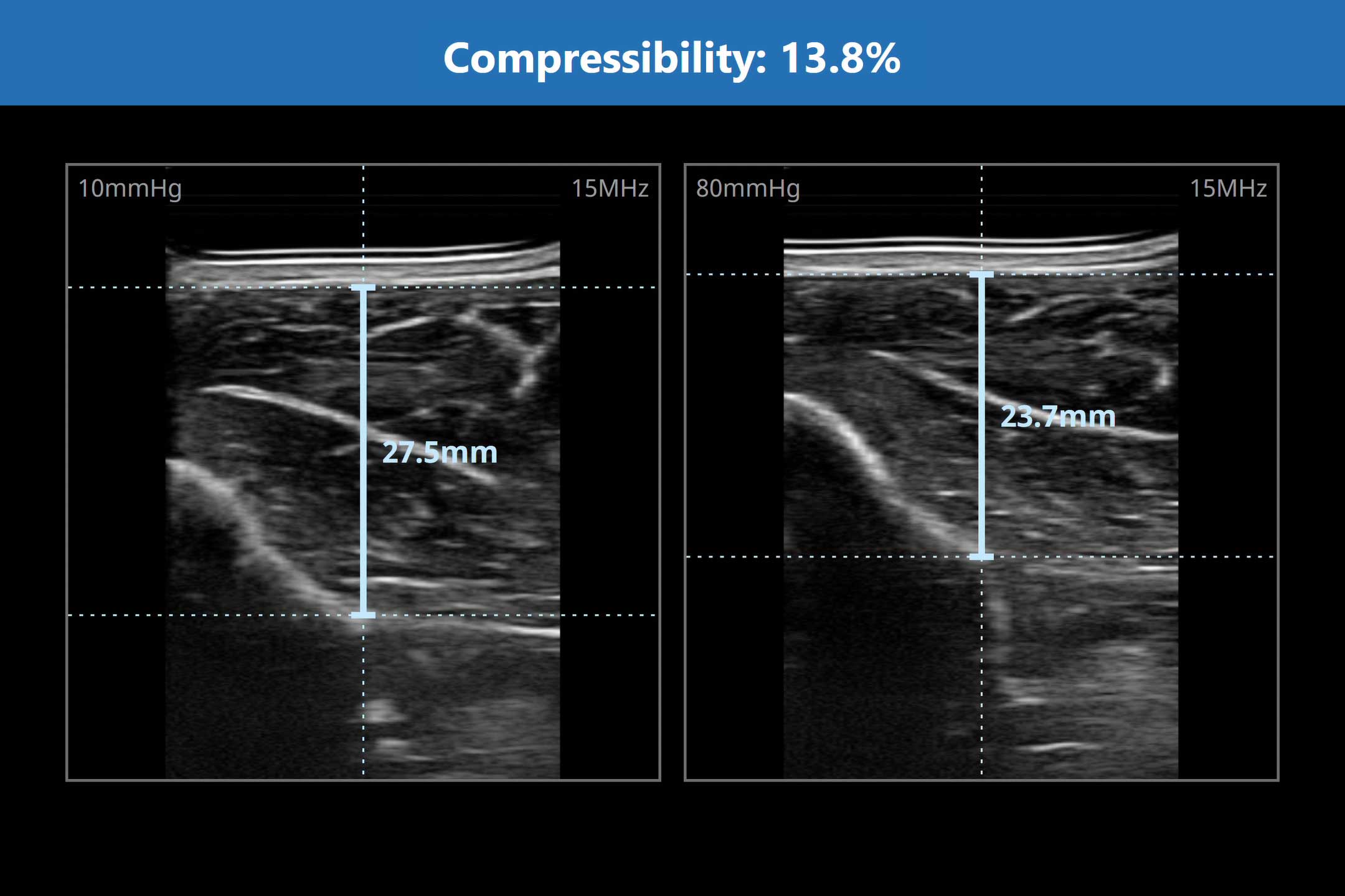 Soft Tissue, Quantified.