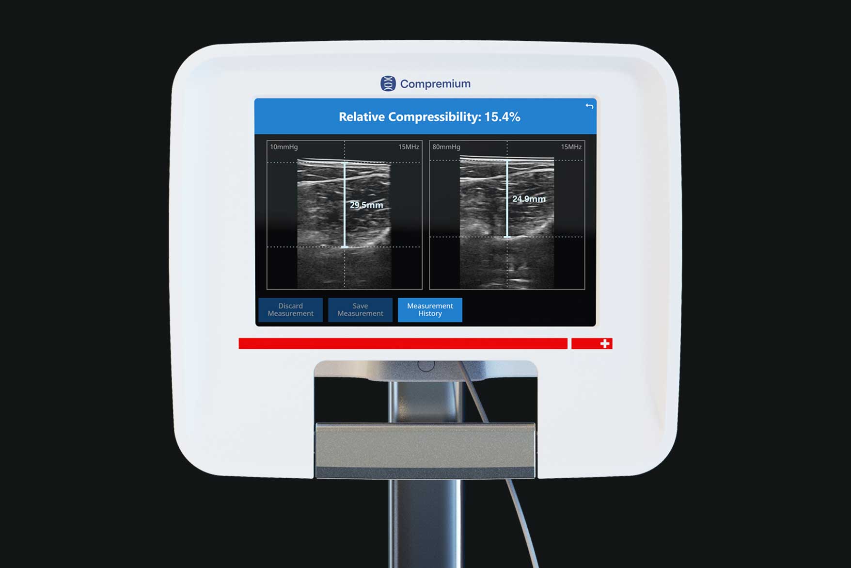 Why Quantification Matters for Ortho Trauma Care
