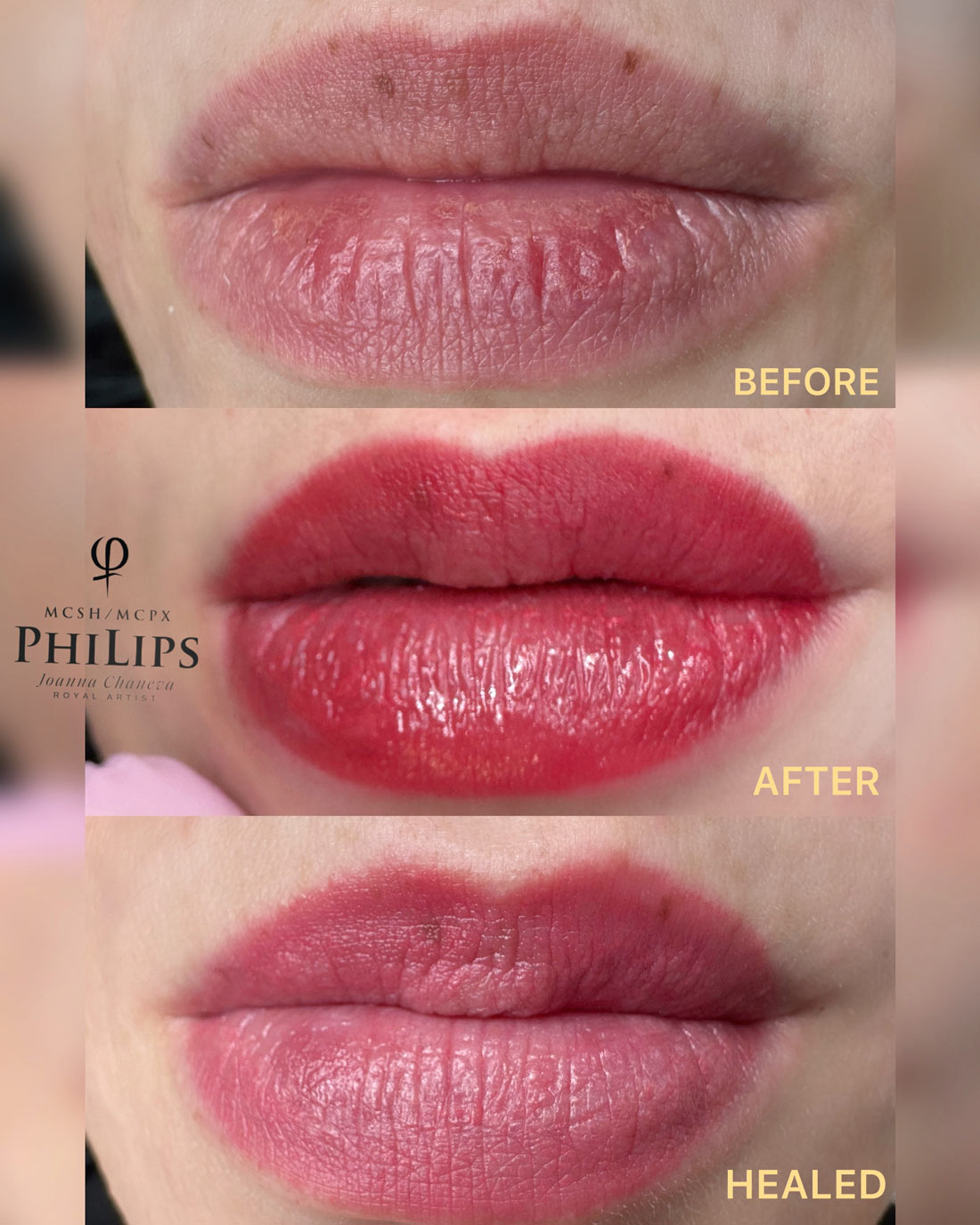 PMU Lippen Classic München