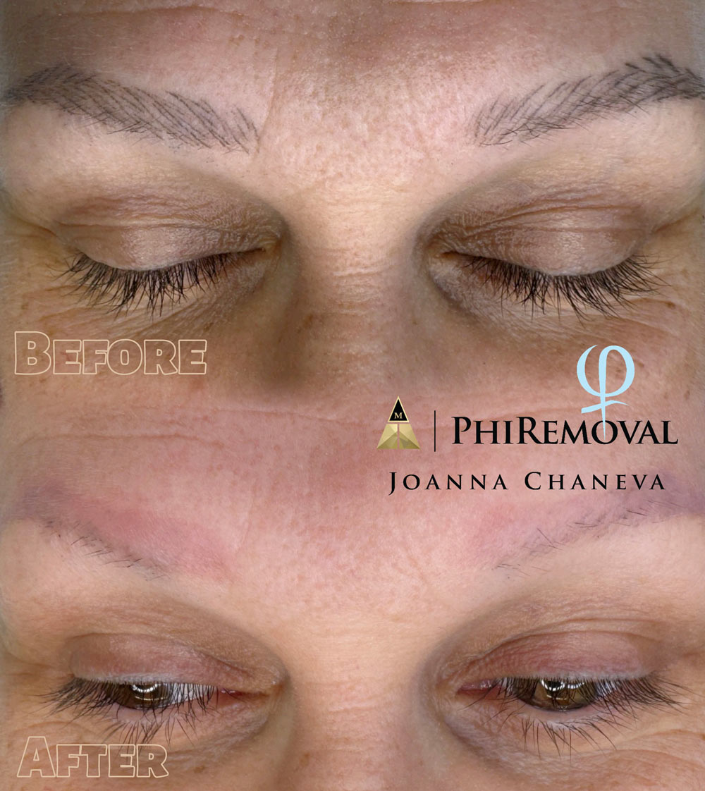 Microblading Heilungstag 1 – frisch pigmentierte, klare Linien München