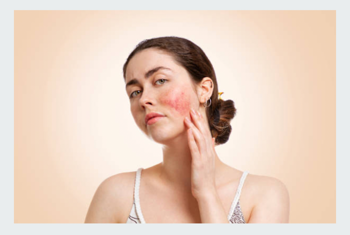 Skin Pigmentation Laser Session