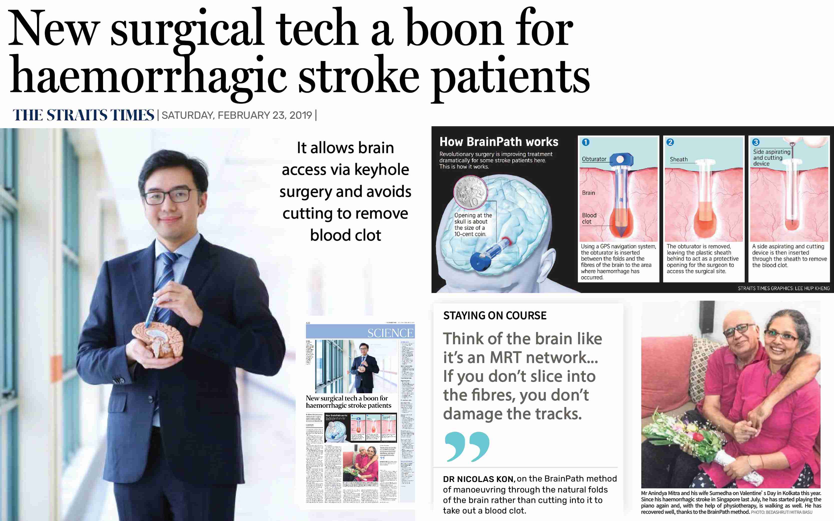 Minimally Invasive Brain Surgery for Haemorrhagic Stroke in Singapore