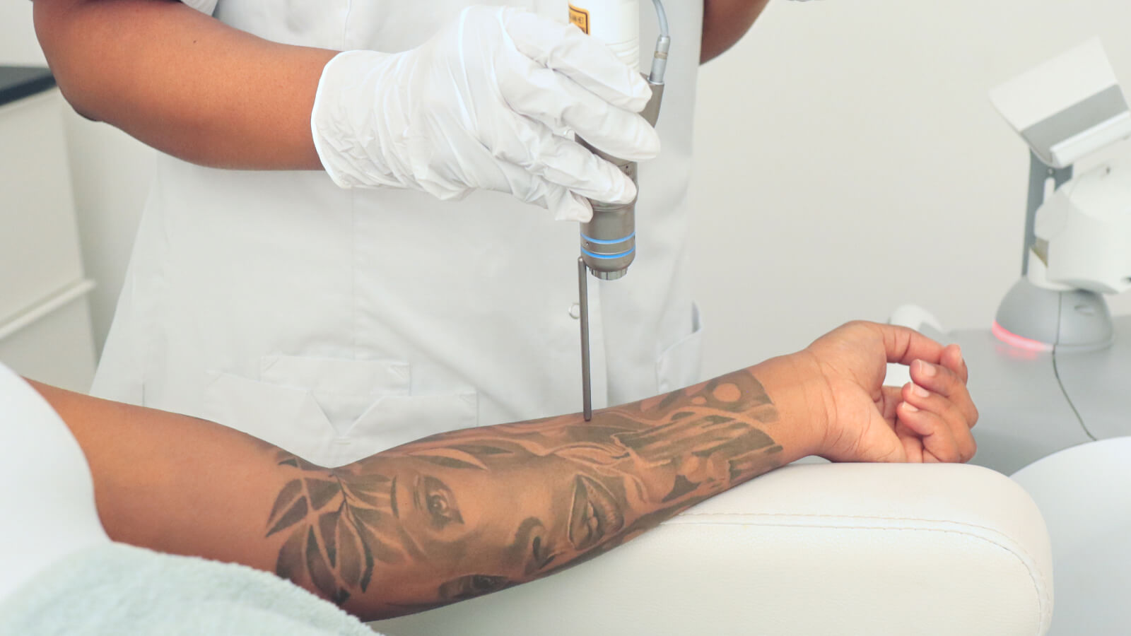 Tattoo Removal