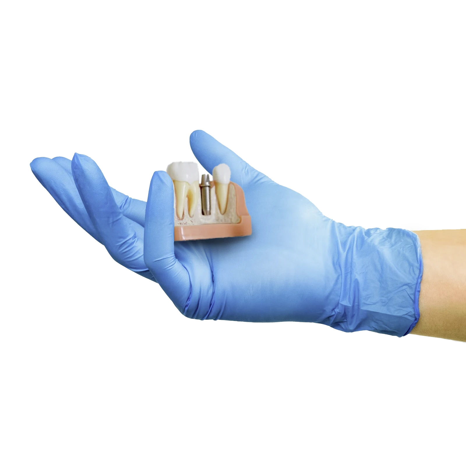 Hand mit blauem Handschuh hält ein Modell eines Implantates
