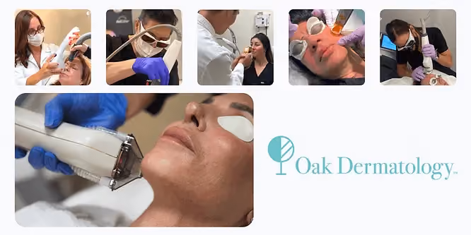 Oak Derm Lasers