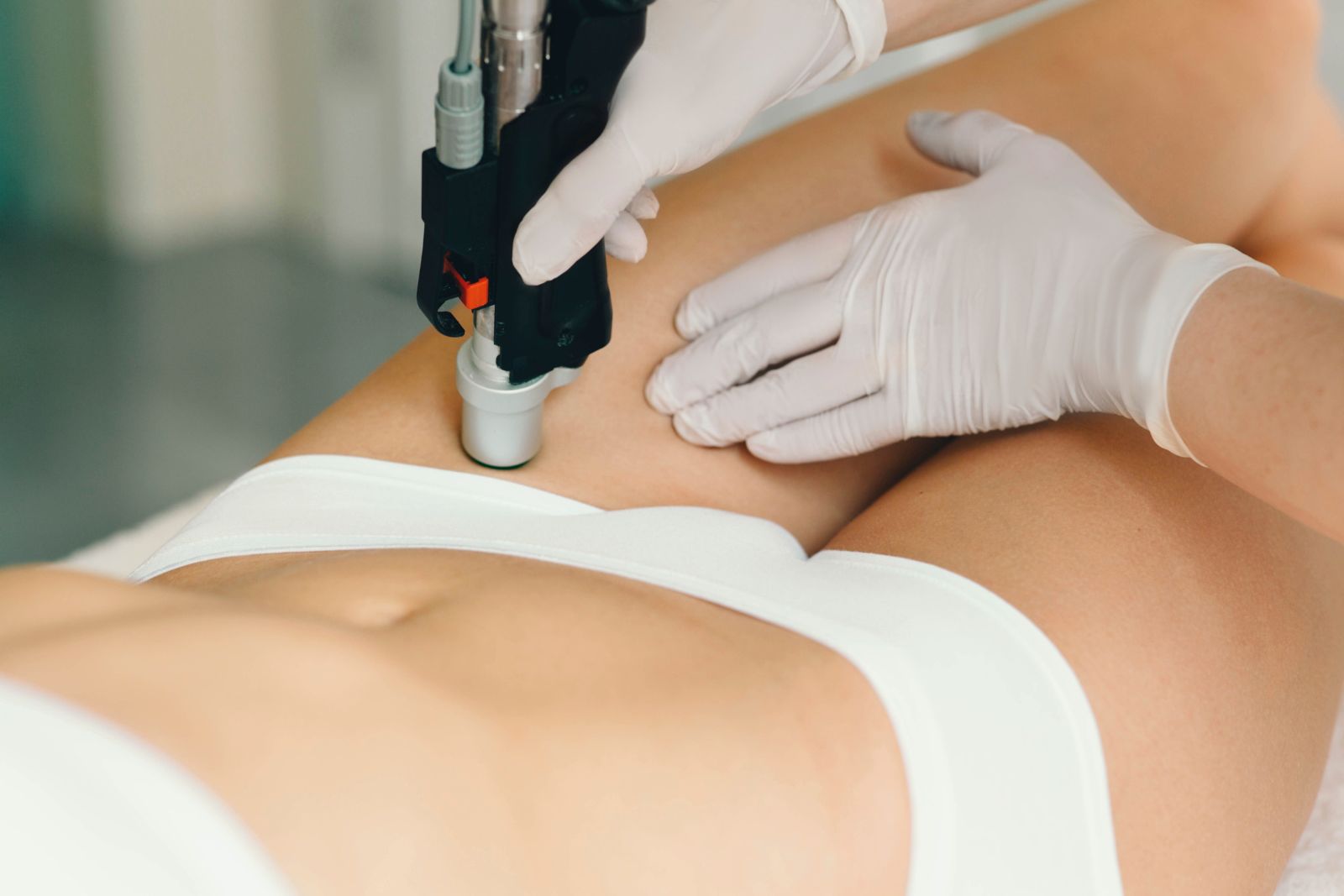 Lời khuyên của chuyên gia về triệt lông vùng bikini bằng laser