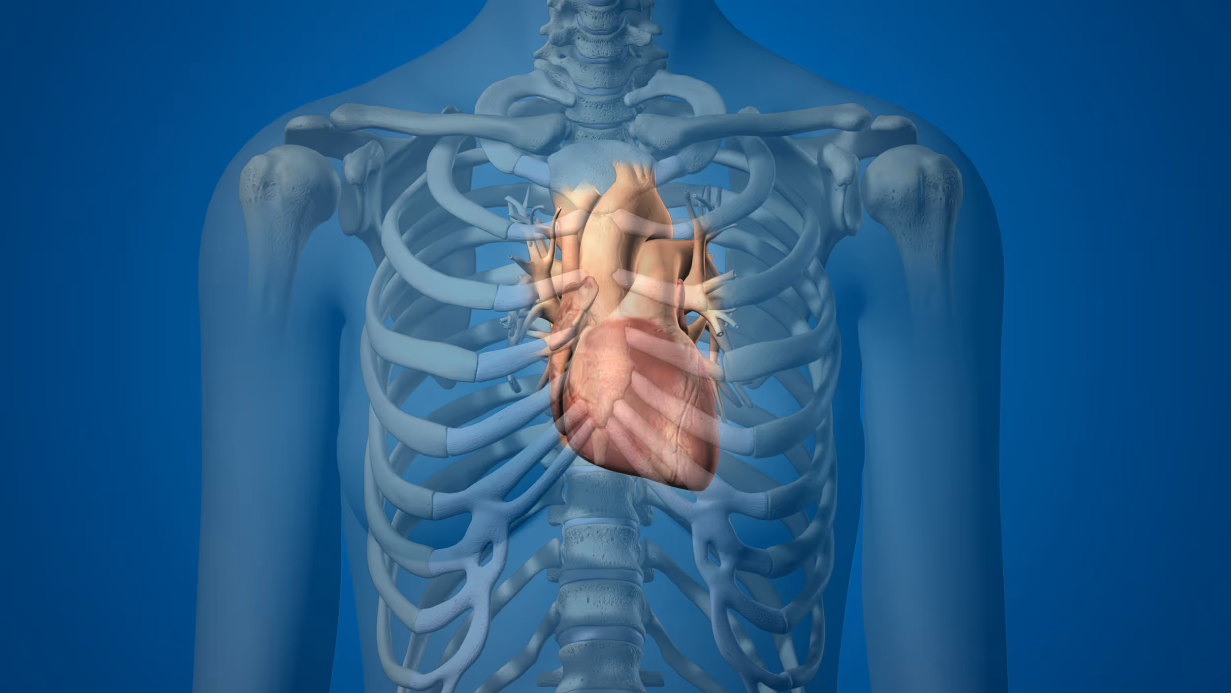 LSI Solutions Cardiac Image