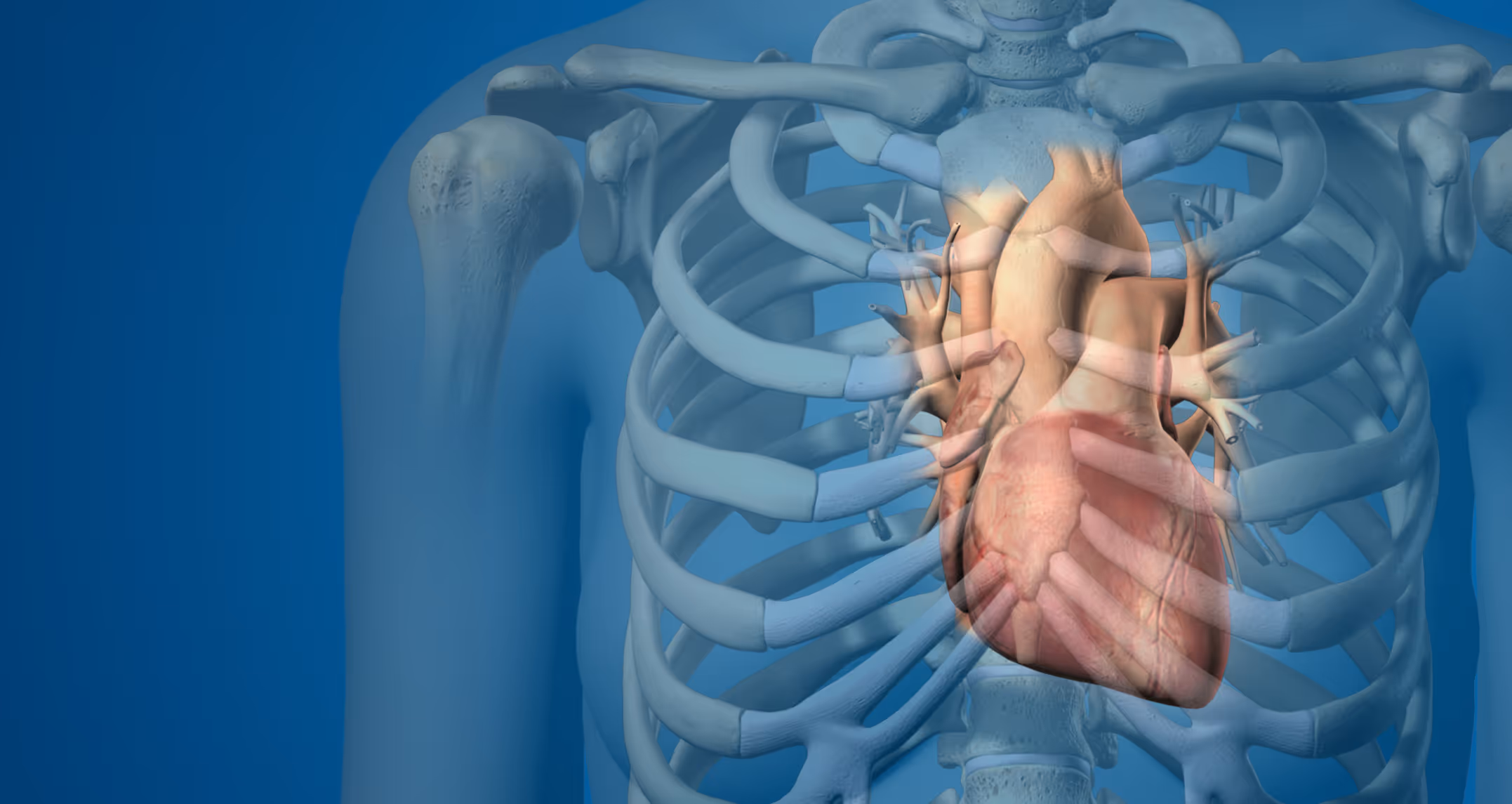 LSI Solutions Cardiothoracic