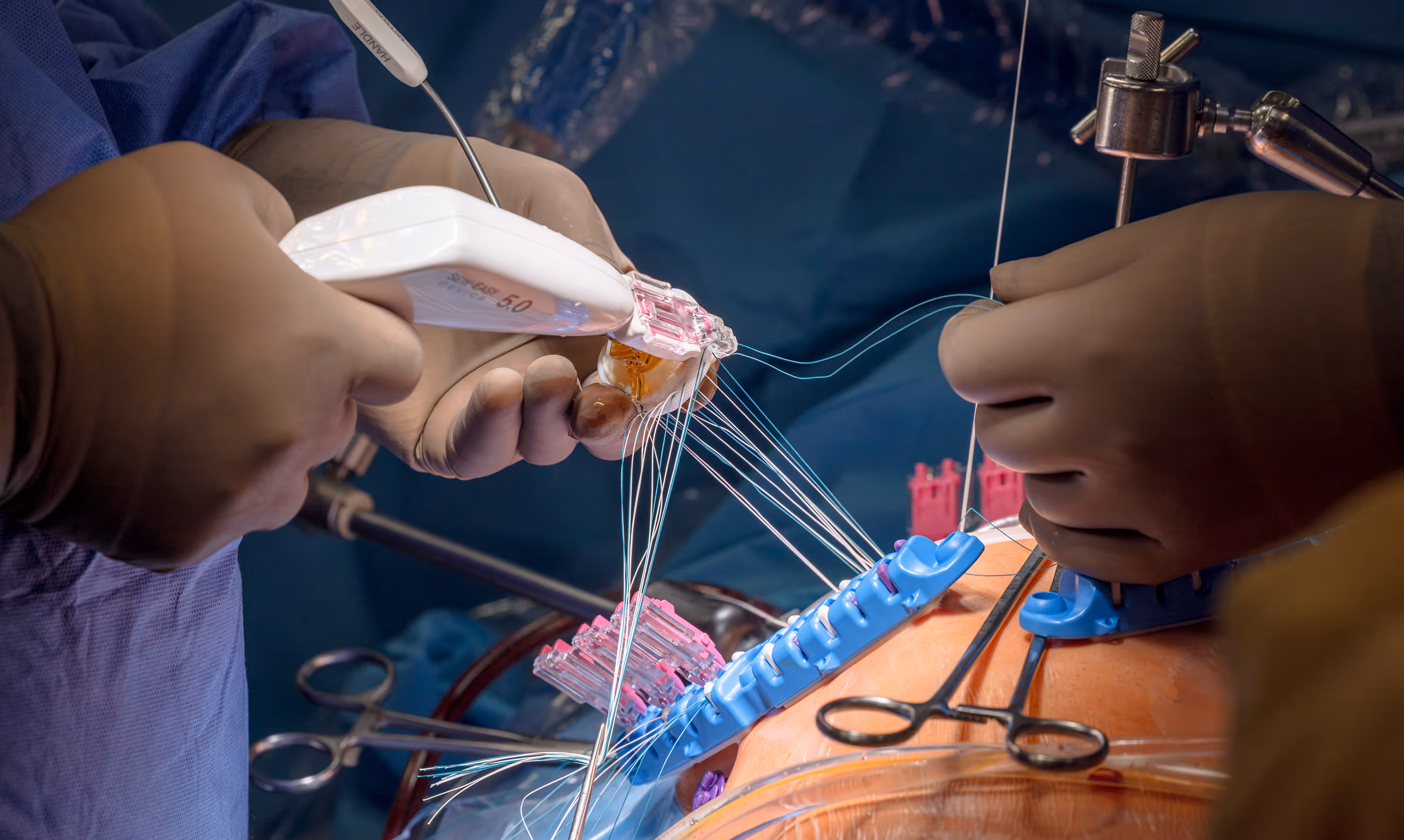 MVR Prosthetic Suturing