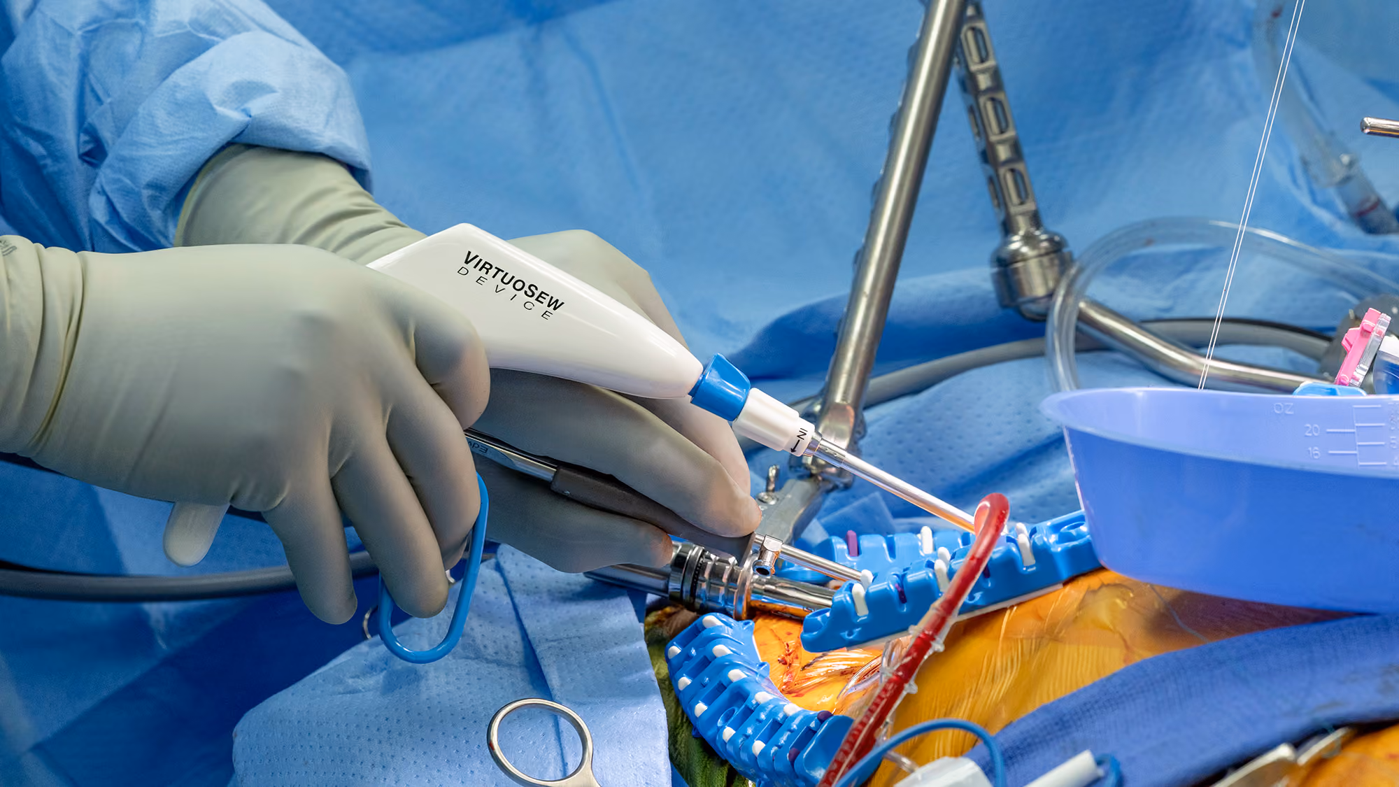 μMVr using VirtuoSEW Device by LSI Solutions