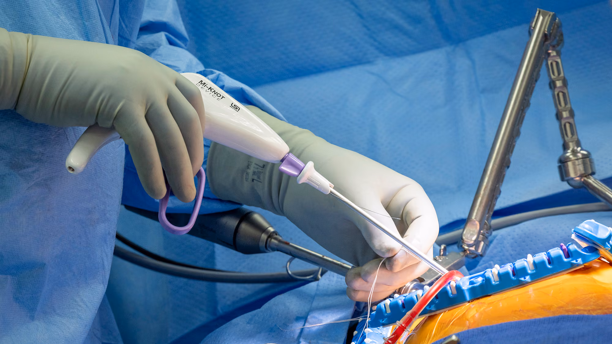 μMVr using Mi-KNOT Device by LSI Solutions