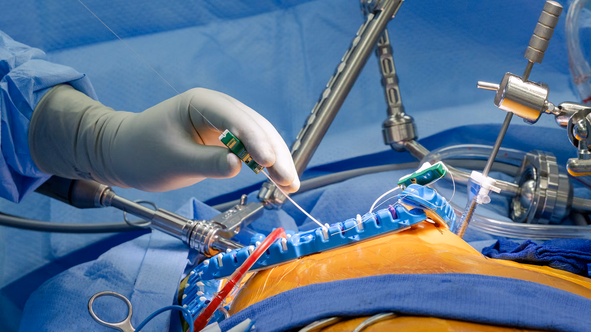 μMVr using miniRUMEL device by LSI Solutions