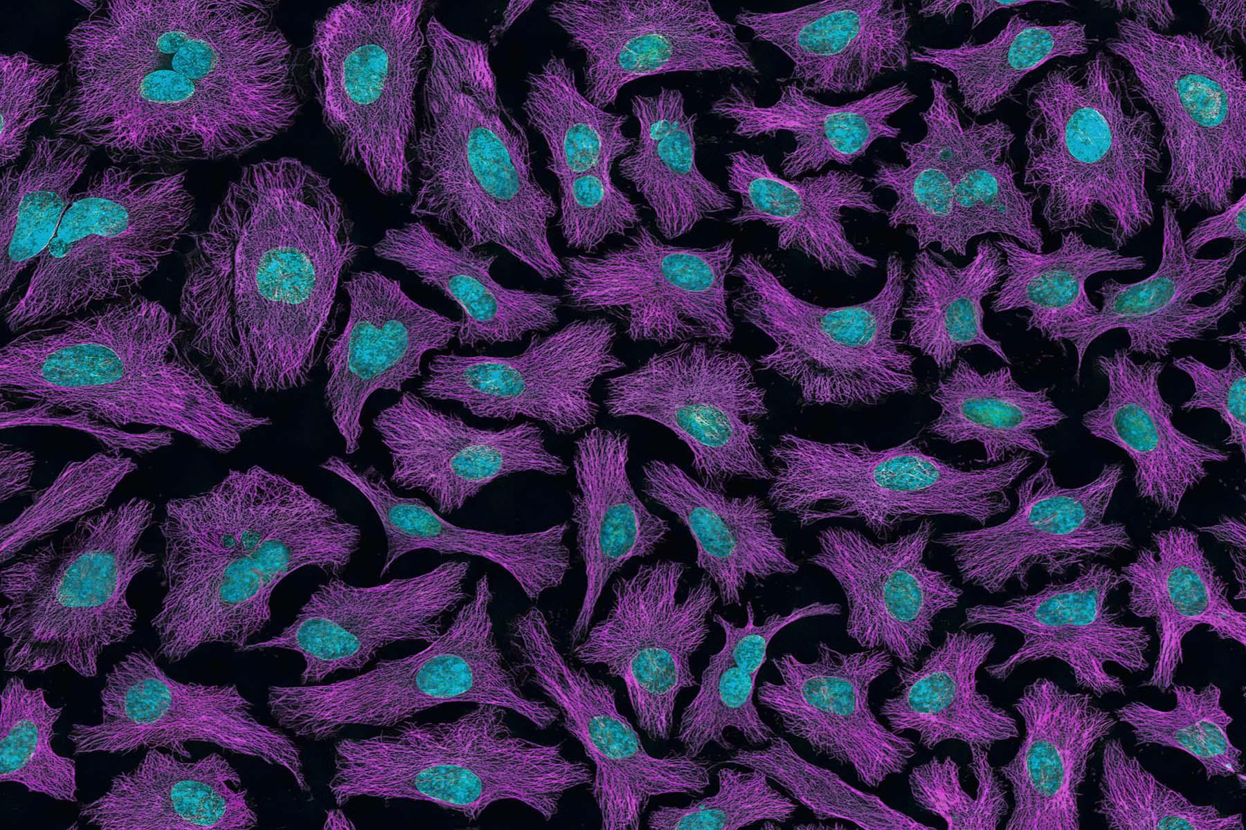Blue and Pink Cells from cervical cancer