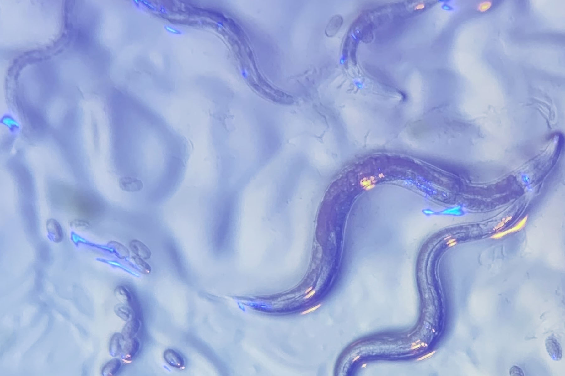 C. elegans with blue and yellow lights in the background