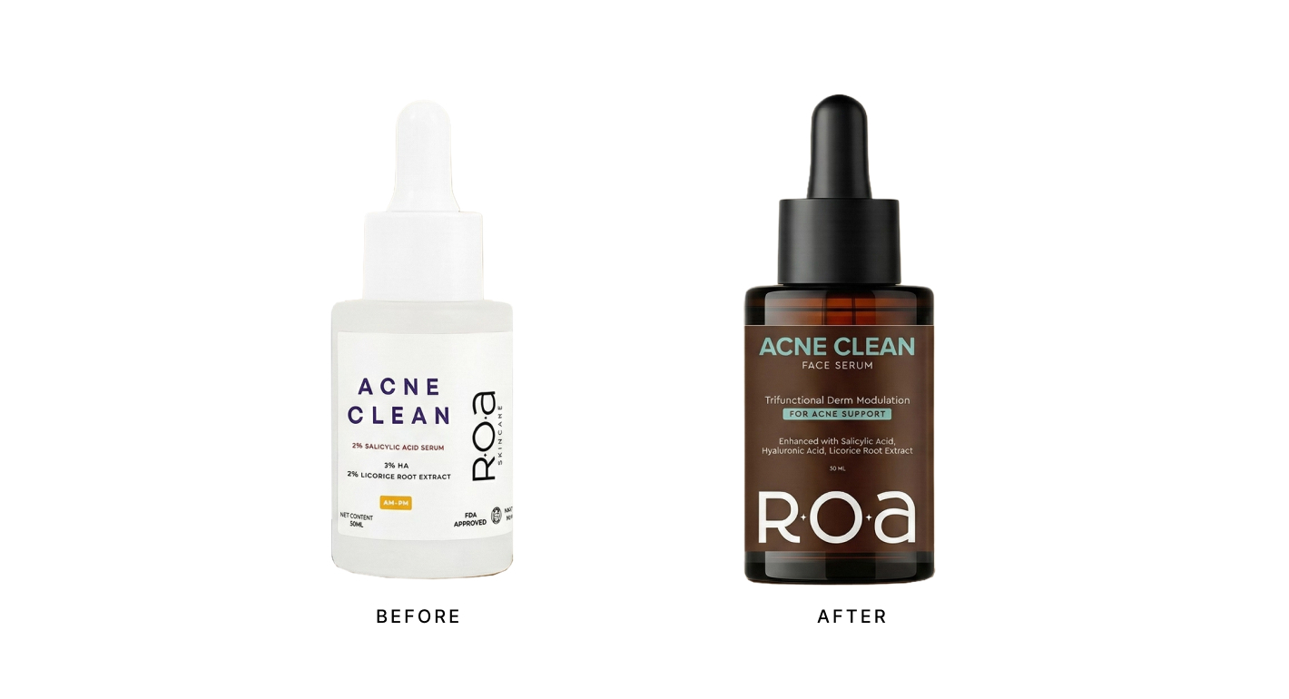 ROA Acne Clean serum packaging shown in a before-and-after comparison.