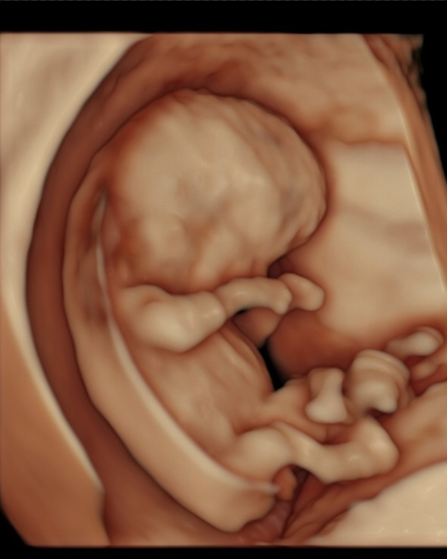 Fetus, 3D, 1. Trimester
