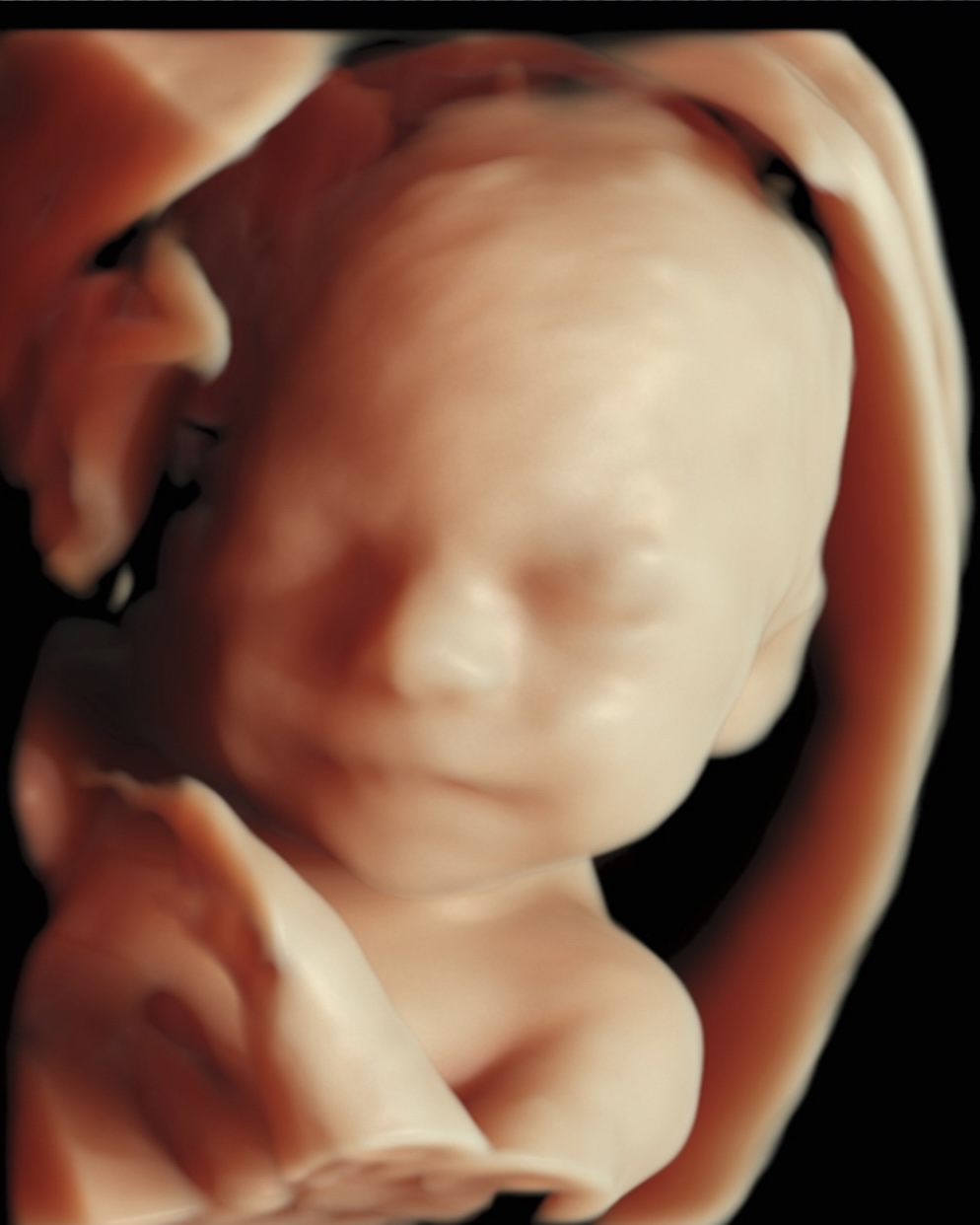 Fetus, 3D, 2. Trimester