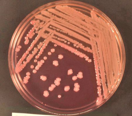 Decode the Plate: Distinguishing Pathogens versus Normal Flora Across Body Sites thumbnail