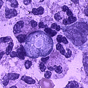Free-Living Amoeba as Agents of Infection thumbnail