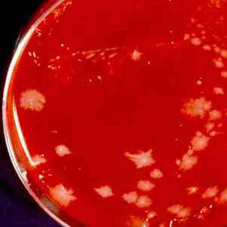 Drug-Resistant Superbugs, Multi-drug Resistant Organisms: MRSA, VRE, Clostridioides difficile, and CRE thumbnail
