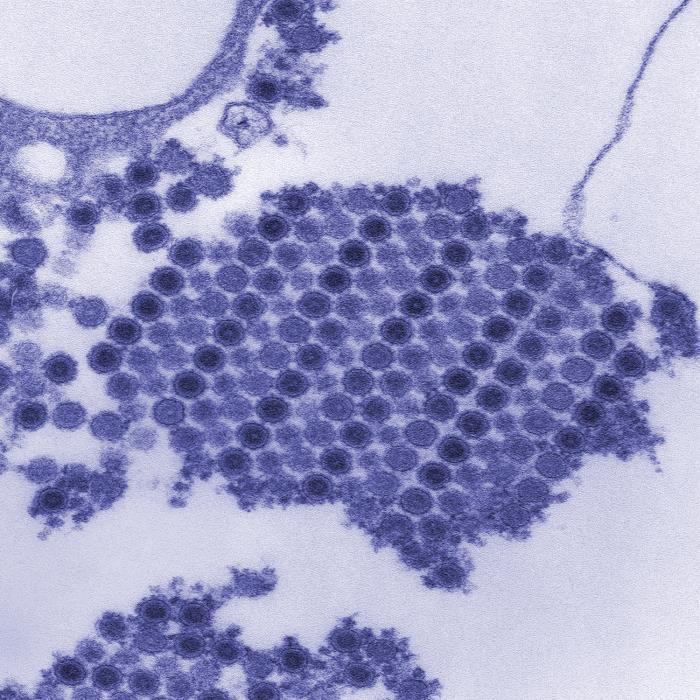 Chikungunya Overview: Quick Facts for Laboratory Professionals thumbnail